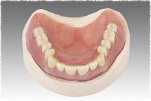 レジン床 義歯