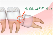 親知らず